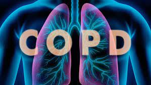 Homeopathic-treatment-for-COPD