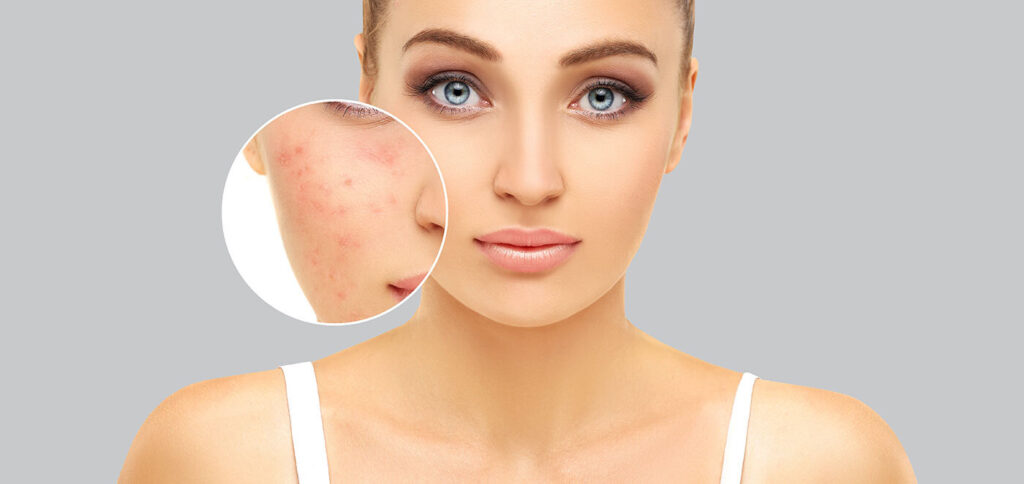Homeopathic-treatment-for-pigmentation