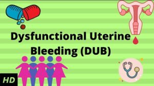 Read more about the article Dysfunctional Uterine Bleeding (DUB)